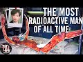 *GRAPHIC* Most Radioactive Man In History | 83 Days Of Pain & Torture | The Death of Hisashi Ouchi