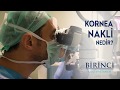 Kornea Nakli | Doç. Dr. Faik ORUÇOĞLU | Birinci Göz Hastanesi