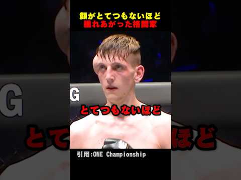 顔が腫れあがった格闘家