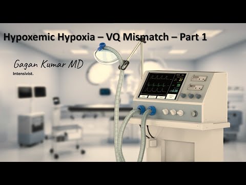 VQ mismatch - what you really need to know ?