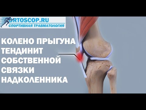 Путевой сустав Реабилитация после эндопротезирования коленного сустава в домашних