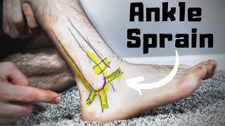 Twisted or Rolled Ankle Sprain Treatment: FASTER Home Recovery Time!