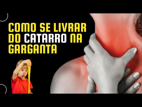 CATARRO PRESO NA GARGANTA: Como eliminar secreção entre o nariz e garganta com pigarro e tosse