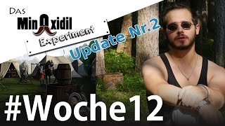 Das Minoxidil Experiment #Woche12 | Allergieupdate und Speedpainting Nr.2