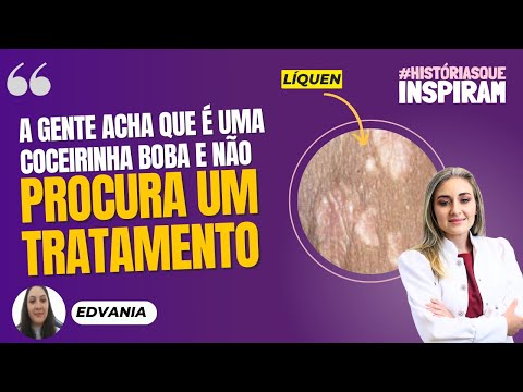 Thumbnail do vídeo
