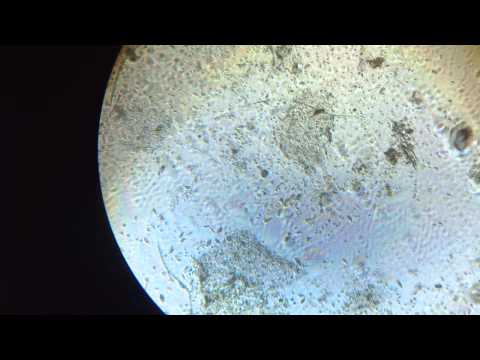 Enterobius vermicularis parazitológia