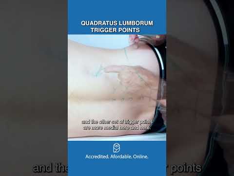 Are Quadratus Lumborum Trigger Points Causing Your Back Pain?