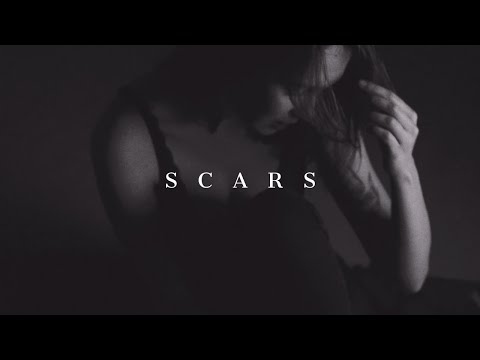 download lagu mp3 mp4 Scars Free, download mp3 Scars Free free downloadn, video klip Scars Free