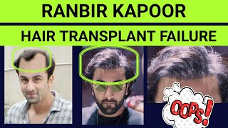 Case study: Ranbir Kapoor's Hair Transplant Case | Detectable Hair Line | Reason of Baldness | The S video