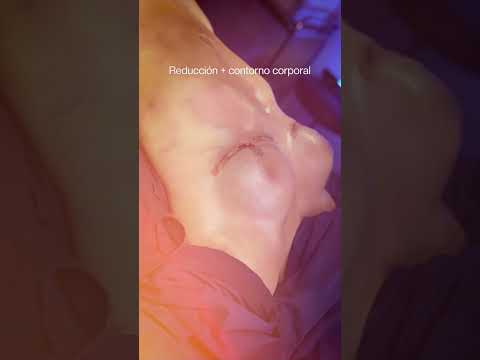 Video Resultado Real