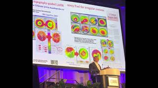 Download Lagu Custom ablation keynote @ ISRS /AAO 2022 in Chicago Thumbnail