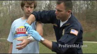 Bleeding Control: Arterial Bleeding