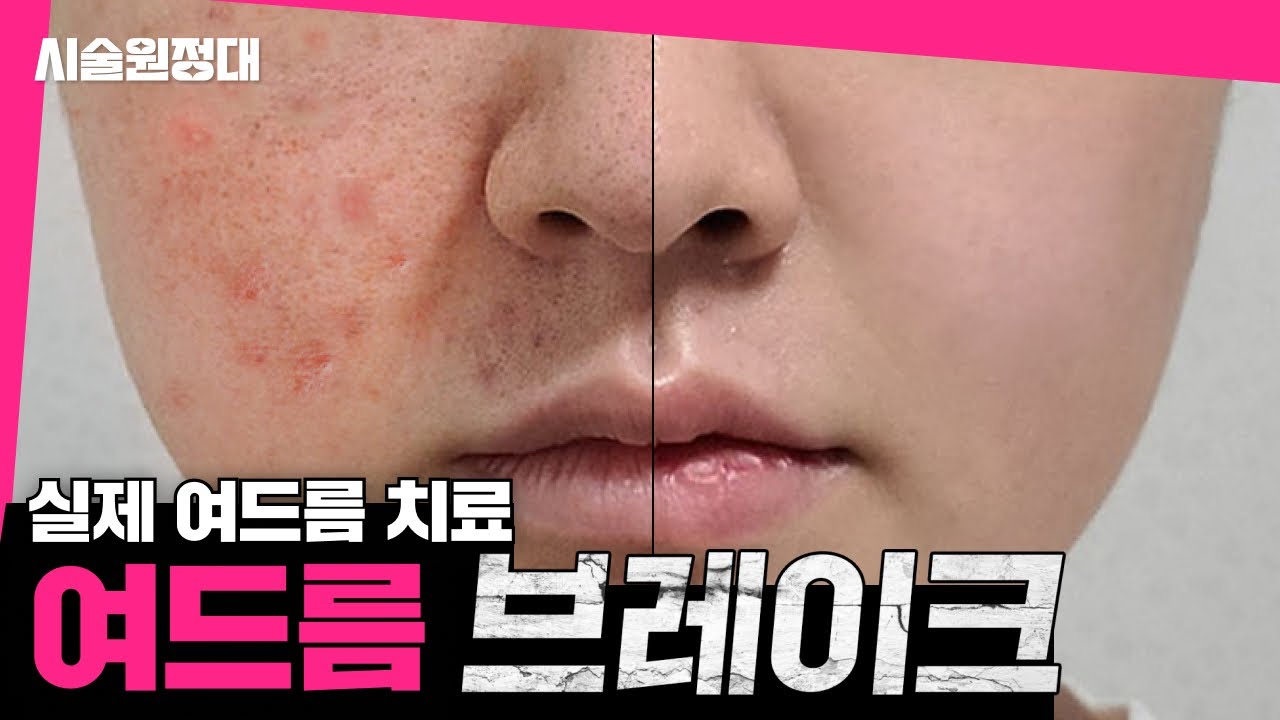 related_video_thumbnail