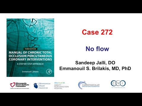 Case 272: Manual of CTO PCI - No flow