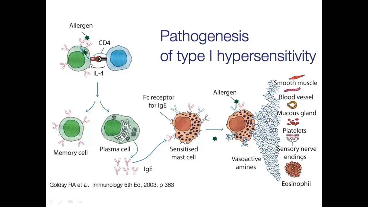 Hipersensibilidades (1/5): Tipo I - Alergias