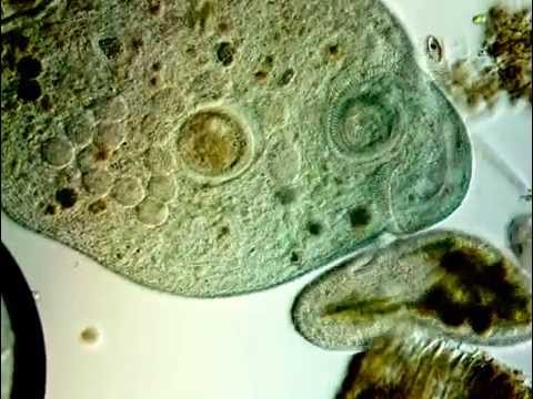 Stentor, the Incredible Protist_P2_Movie 637