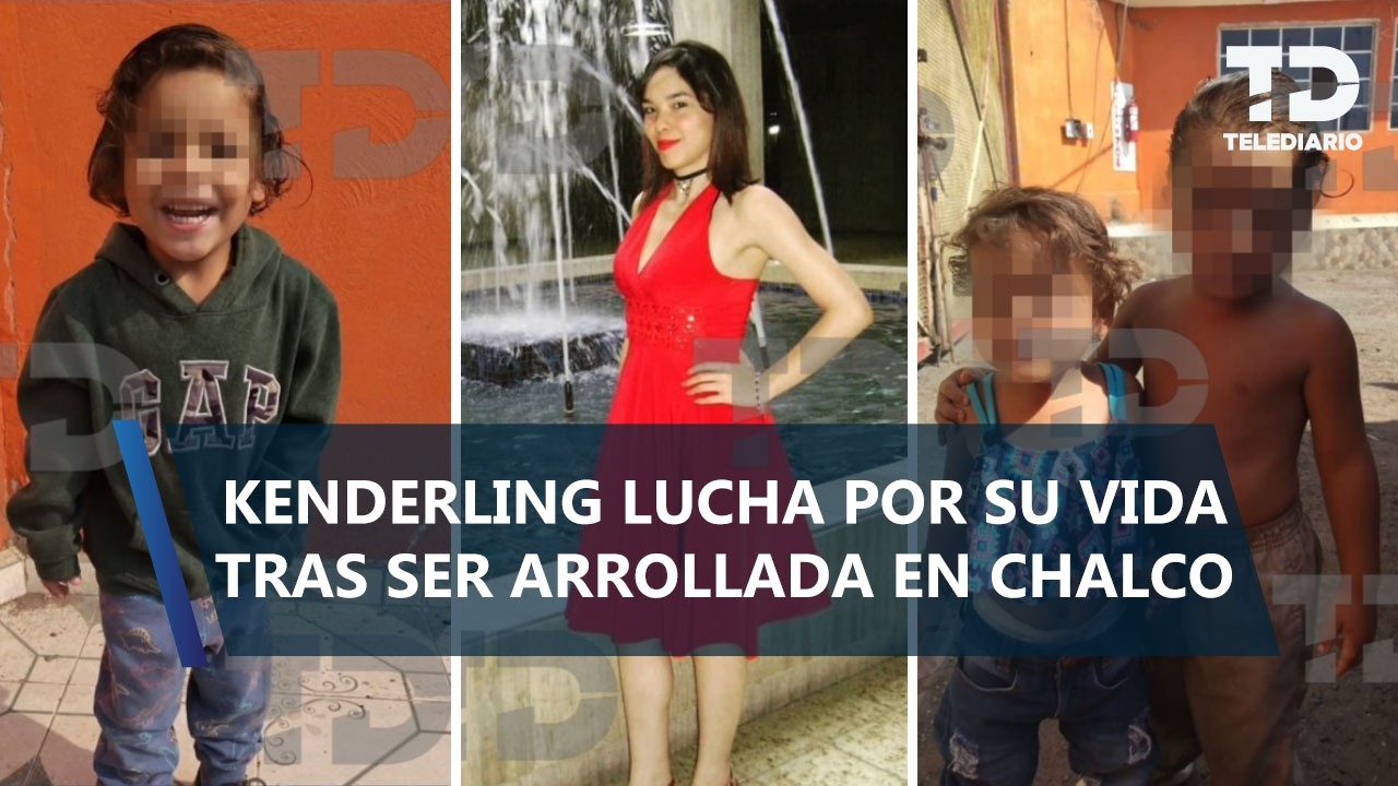 Kenderling, de 3 años, lucha por vivir tras ser arrollada con su familia en Chalco
