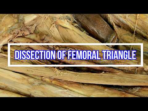 Dissection of Femoral Triangle