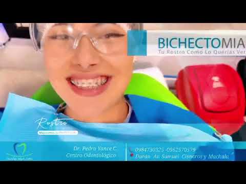 Bichectomia (Reducción de Mejilla)  - Durán Ecuador #odontólogo #duran #guayas #Reina #Rostro