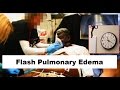 The Best 10 Pink Frothy Sputum Pulmonary Embolism