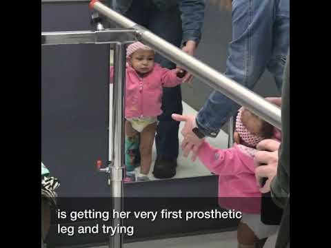 Little girl tries on prosthetic leg for the first time.