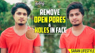 How to get rid of OPEN PORES And HOLES NATURALLY | In TAMIL