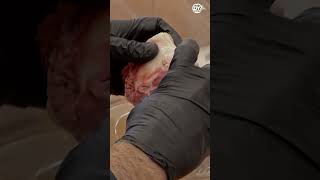 Visual Shiur: The Kaneh (Trachea) Up Close