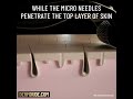Beard Growth Kit With Free Beard Roller Animation