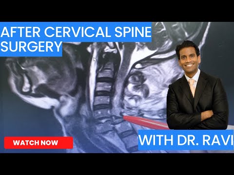 How To Recover From:  CERVICAL SPINE SURGERY post-operative instructions with Dr. RAVI