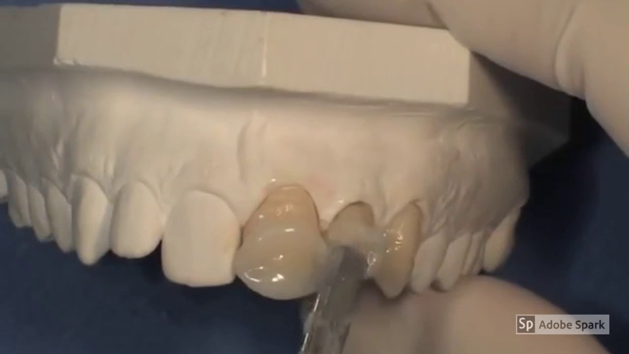 Videolezione Prof Ciccone il provvisorio