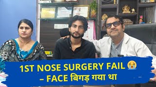 पहली नाक की सर्जरी ने सब बिगाड़ दिया 😢 लेकिन अब देखिए Final Result 👃🔥