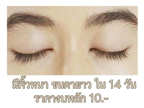 Tse scho Takeo โรคสะเก็ดเงิน ครีมมหัศจรรย์สำหรับกลาก