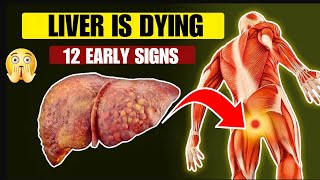 LIVER IS DYING 12 Weird Signs of LIVER DAMAGE (Warning Signs!)