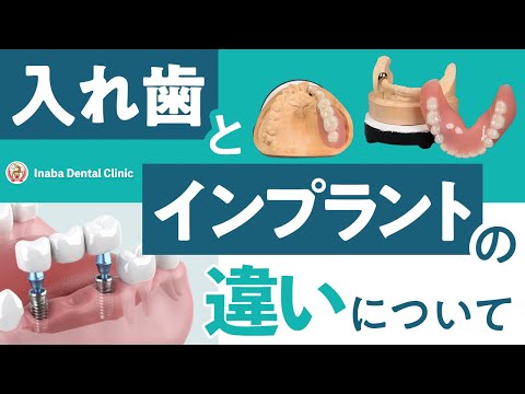 入れ歯とインプラントの違いについて