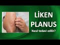 LİKEN PLANUS