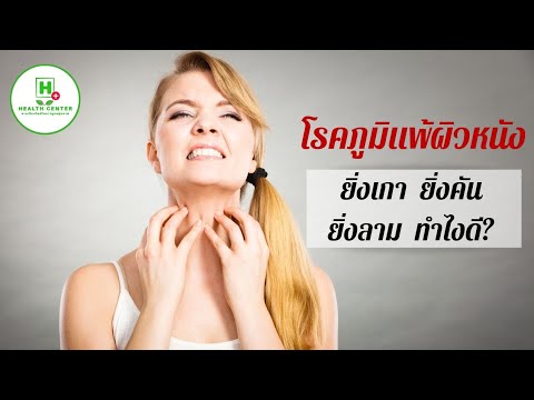 กว่าที่จะละเลงมือของเขามีโรคสะเก็ดเงิน โรคผิวหนังภูมิแพ้, ท้องผูก