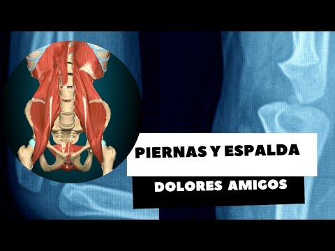 PIERNAS Y ESPALDA DOLORES AMIGOS