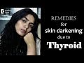 Can thyroid problems cause skin discoloration? Causes & Treatment - Dr. Rasya Dixit