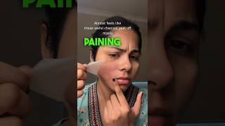 I tried EXTRA LARGE PIMPLE PATCHES OVERNIGHT 😅 #skincare #beautytips #shorts