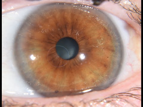 Thumbnail: Family History of Breast Cancer