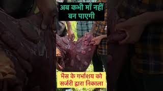 Download lagu Hysterectomy in buffalo l Dr Umar Khan mp3