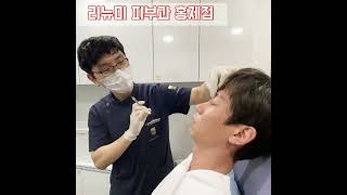 레스틸렌 성형 시술