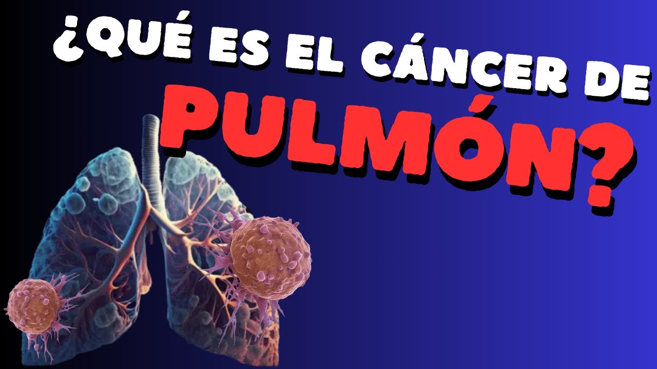 ¿Qué es el cáncer de pulmón?