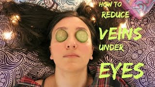 How to Get Rid of Veins and Dark Circles in 5 minute !!!