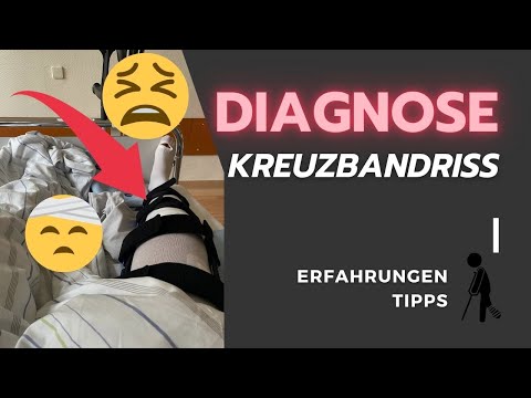 Kreuzbandriss? Meine Erfahrungen & Tipps - 4 Monate nach der Kreuzband Op
