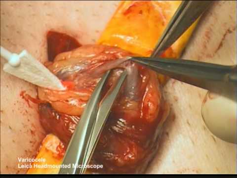 Hämoglobin im Urin von Prostata- Einige Analysen auf Prostata