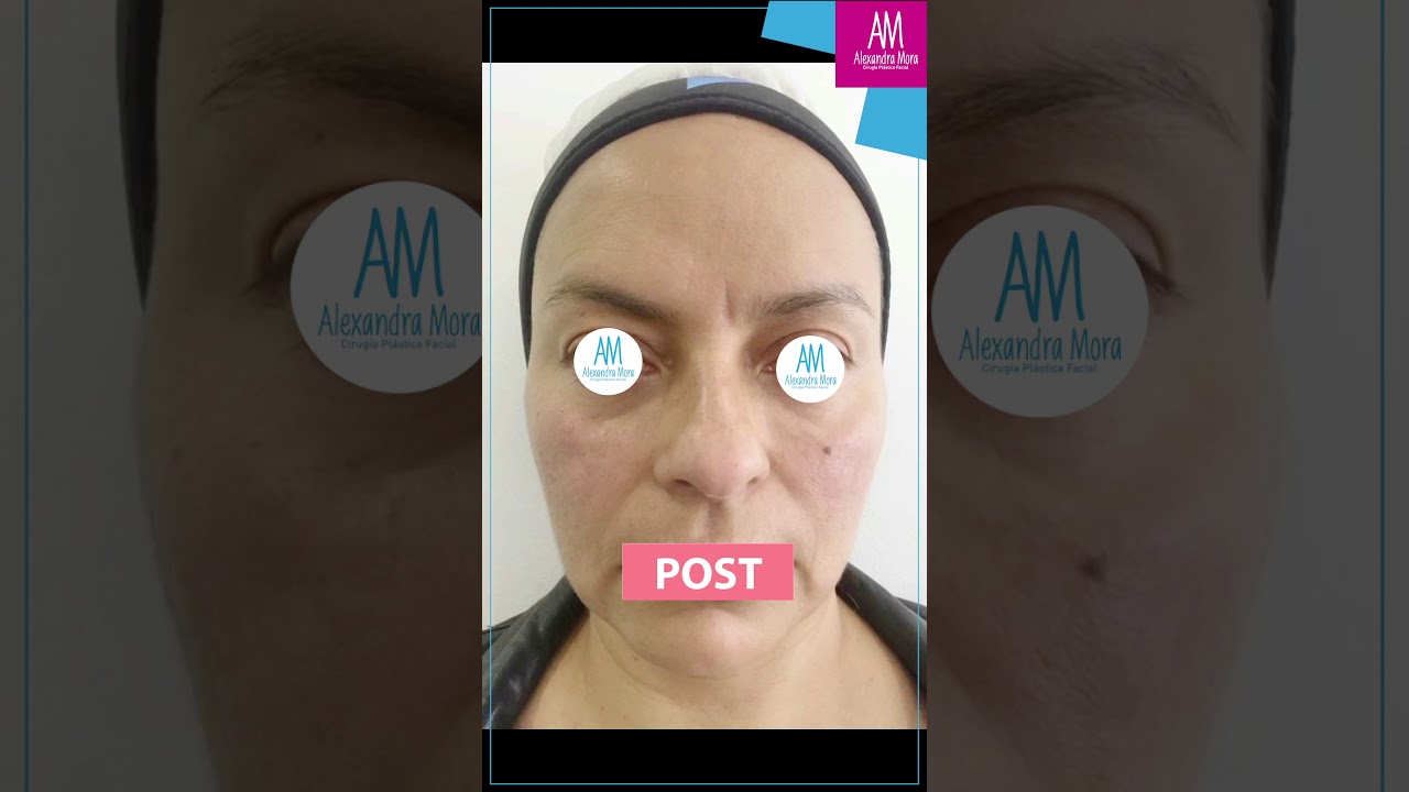 Alexandra Mora Hernandez-162