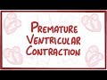 Premature Ventricular Contraction - causes, symptoms, diagnosis, treatment, pathology