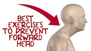 Forward Head Exercises to Fix Forward Head Posture