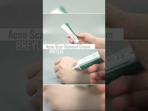 Stretch Marks & Acne Scars—Gone? 💧 Real Review  #skincare #kbeauty #skincareroutine #koreanskincare